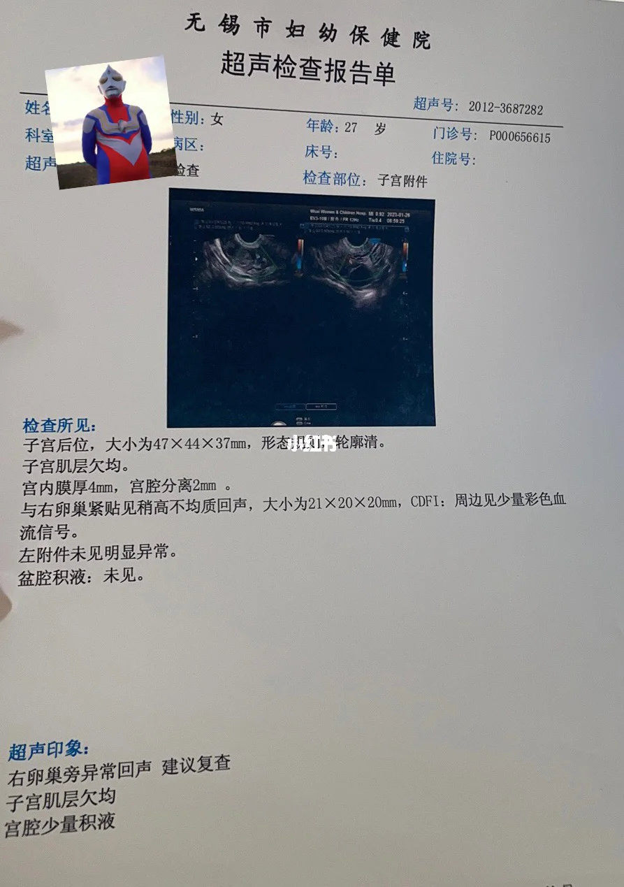 宫外孕会来姨妈吗-(宫外孕会来姨妈吗一般持续多久呢)