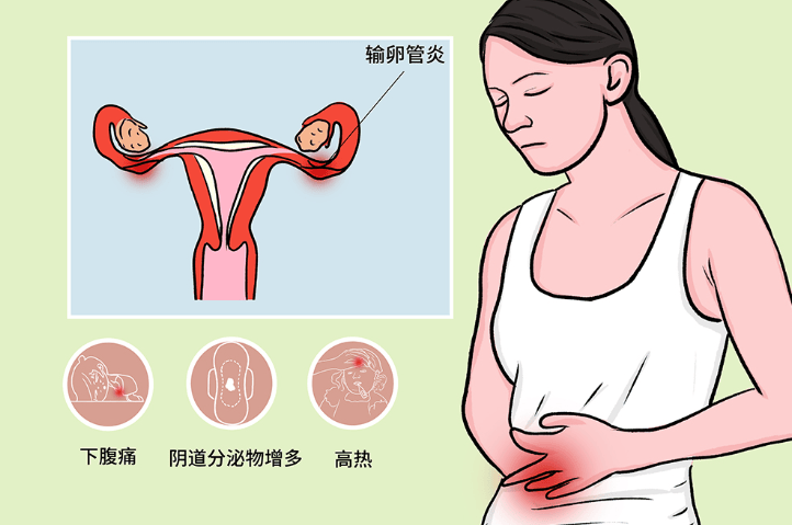 宫外孕什么症状_(宫外孕什么症状,一般什么时间能发现)