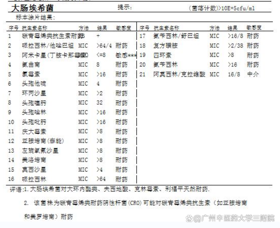 尿液细菌高是什么原因(男性尿液细菌高是什么原因)