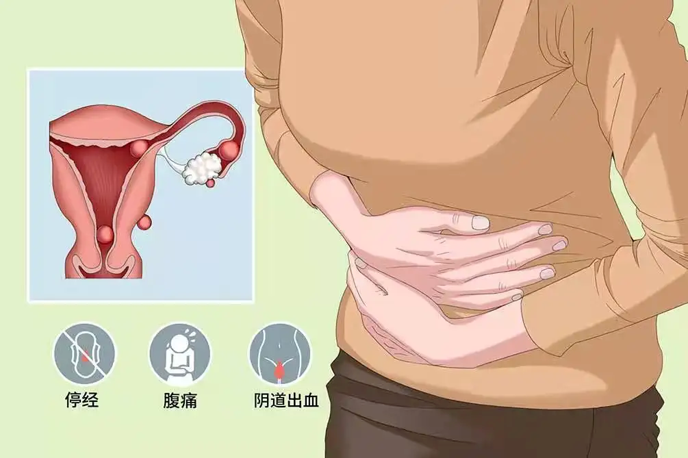 宫外孕还会来月经吗-(得了宫外孕还会来月经吗)