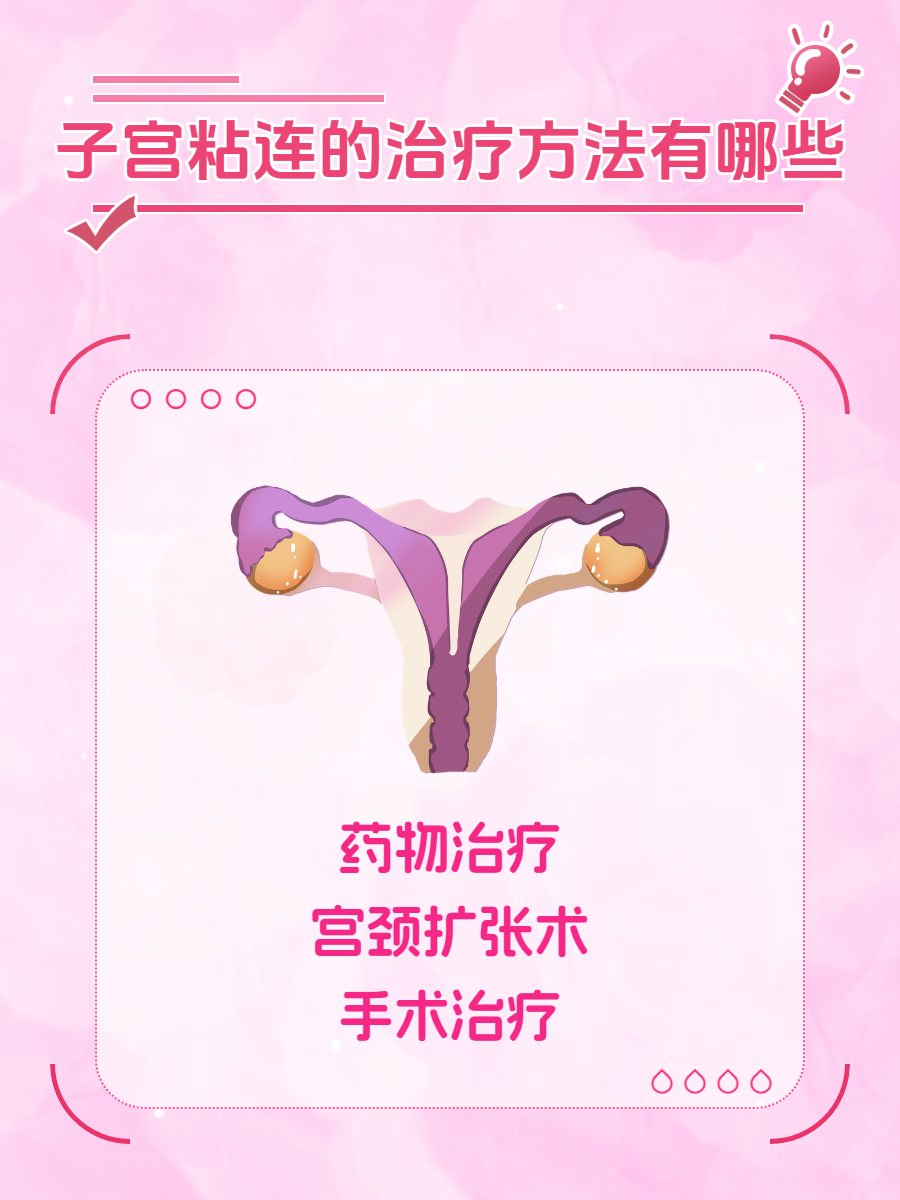 子宫粘连-(子宫粘连最佳治疗方法)