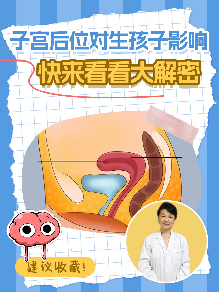 子宫后位(子宫后位的优点和缺点)