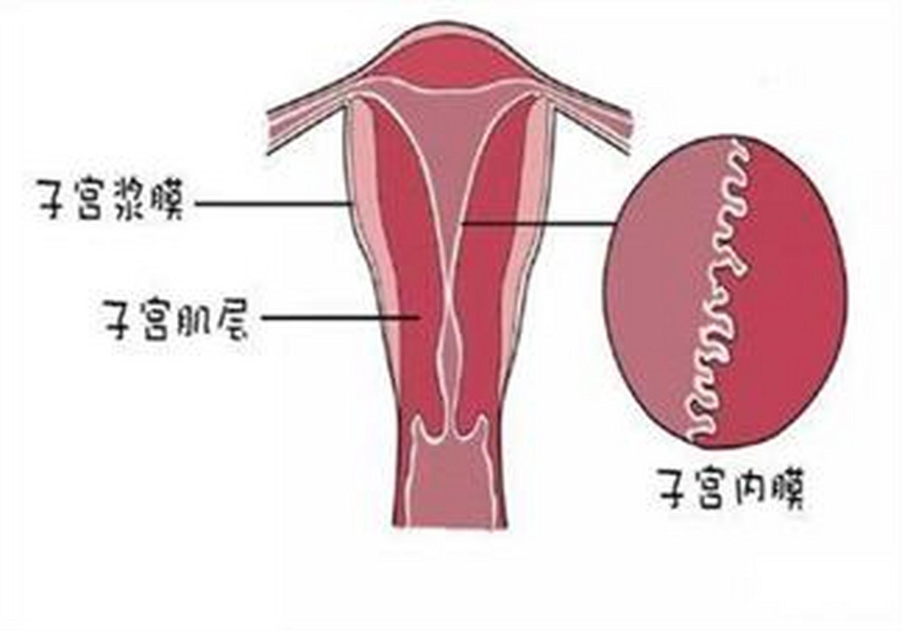 子宫内膜增厚(子宫内膜增厚怎么治疗)