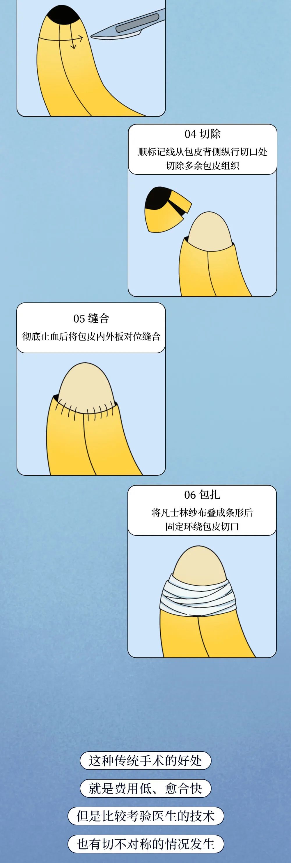 割包皮_(割包皮后悔死了)