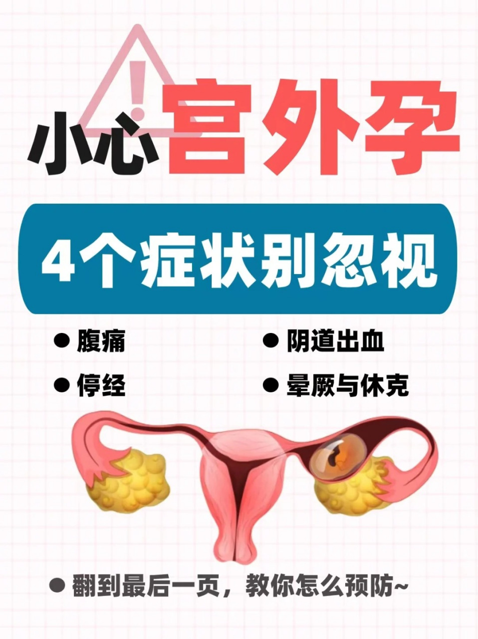 宫外孕_(宫外孕早期症状有哪些)