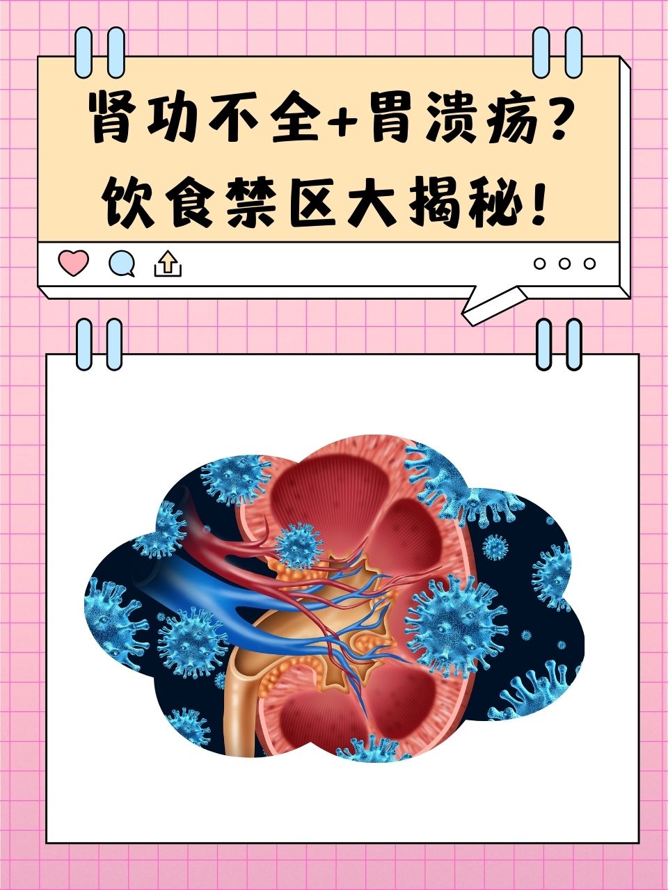 胃溃疡饮食-(胃溃疡饮食方面要注意些什么)