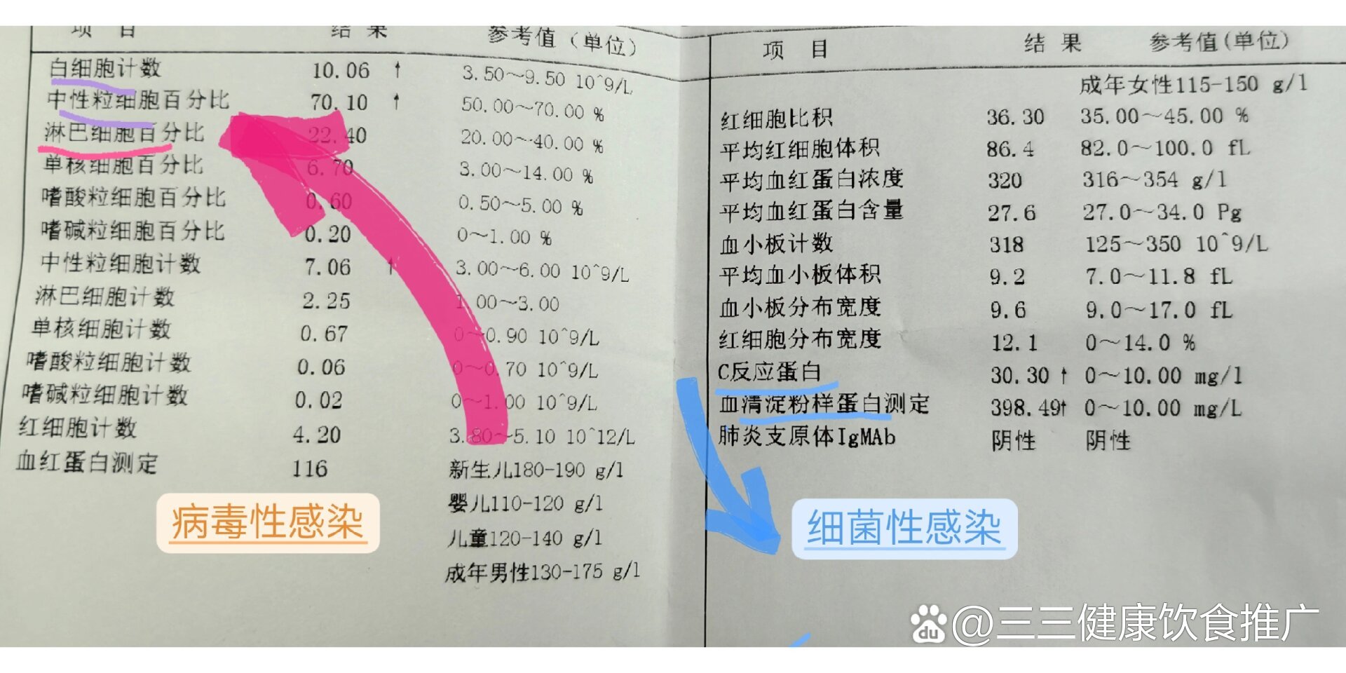 病毒性感冒和细菌性感冒区别(病毒性感冒和细菌性感冒区别会传染吗)