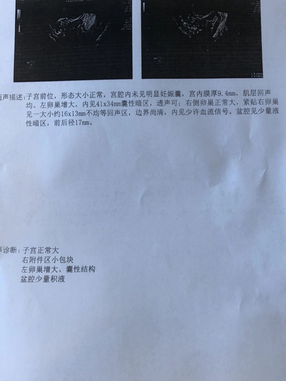 宫外孕保守治疗后多久可以同房-(宫外孕保守治疗后多久可以同房?)