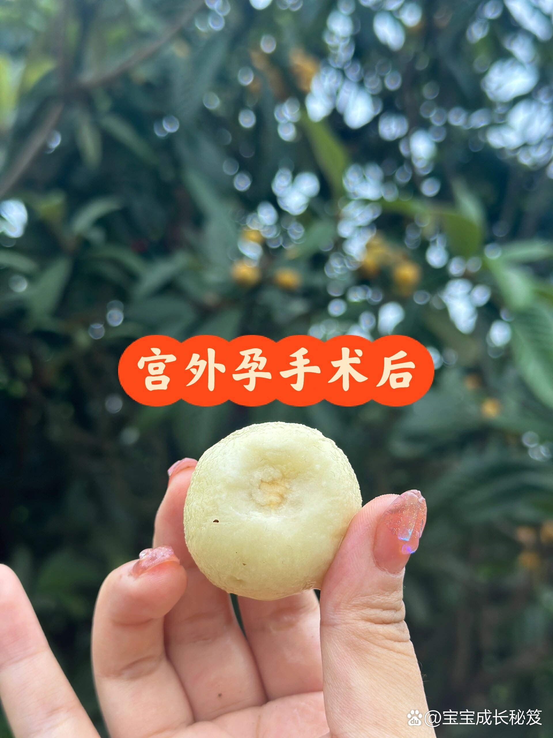 宫外孕会不会来月经-(宫外孕会不会来月经吗)