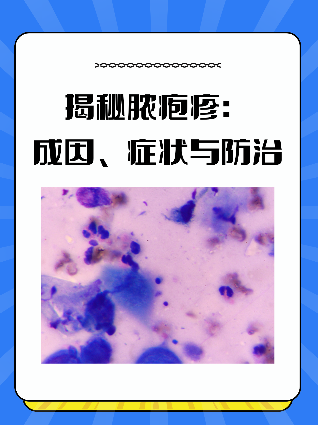 皮肤细菌感染-(皮肤细菌感染用什么药膏效果好)