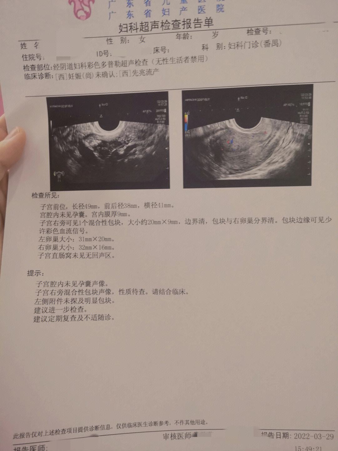 宫外孕验血能查出来吗_(宫外孕的话验血能看出来怀孕吗)