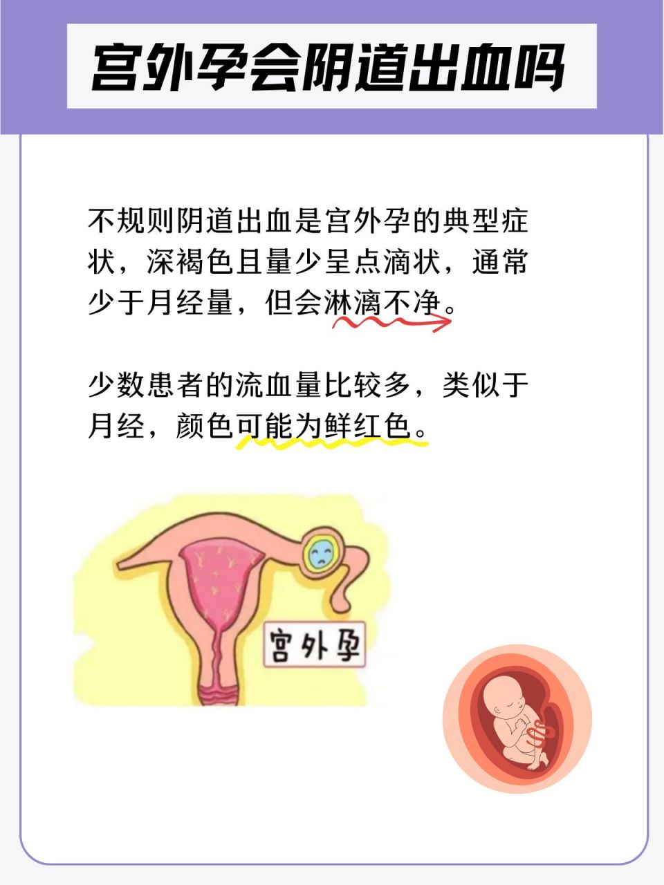 为什么会宫外孕(没有性生活为什么会宫外孕)