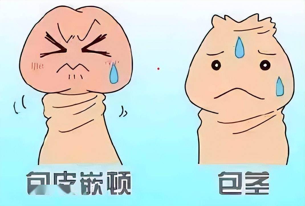 合肥包皮_(合肥包皮环切手术需要多少钱)