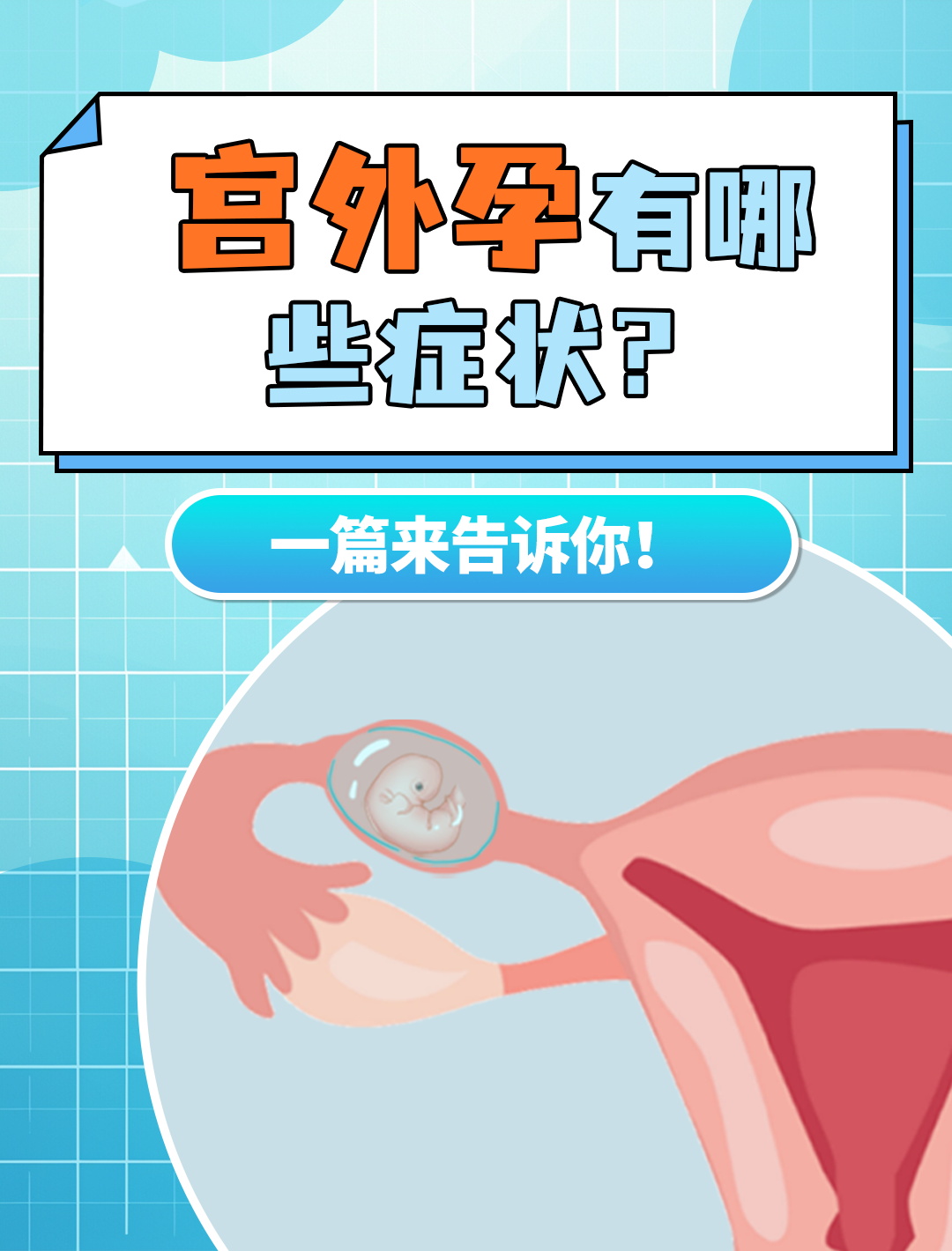 宫外孕是什么引起的-(子宫外怀孕有什么症状)