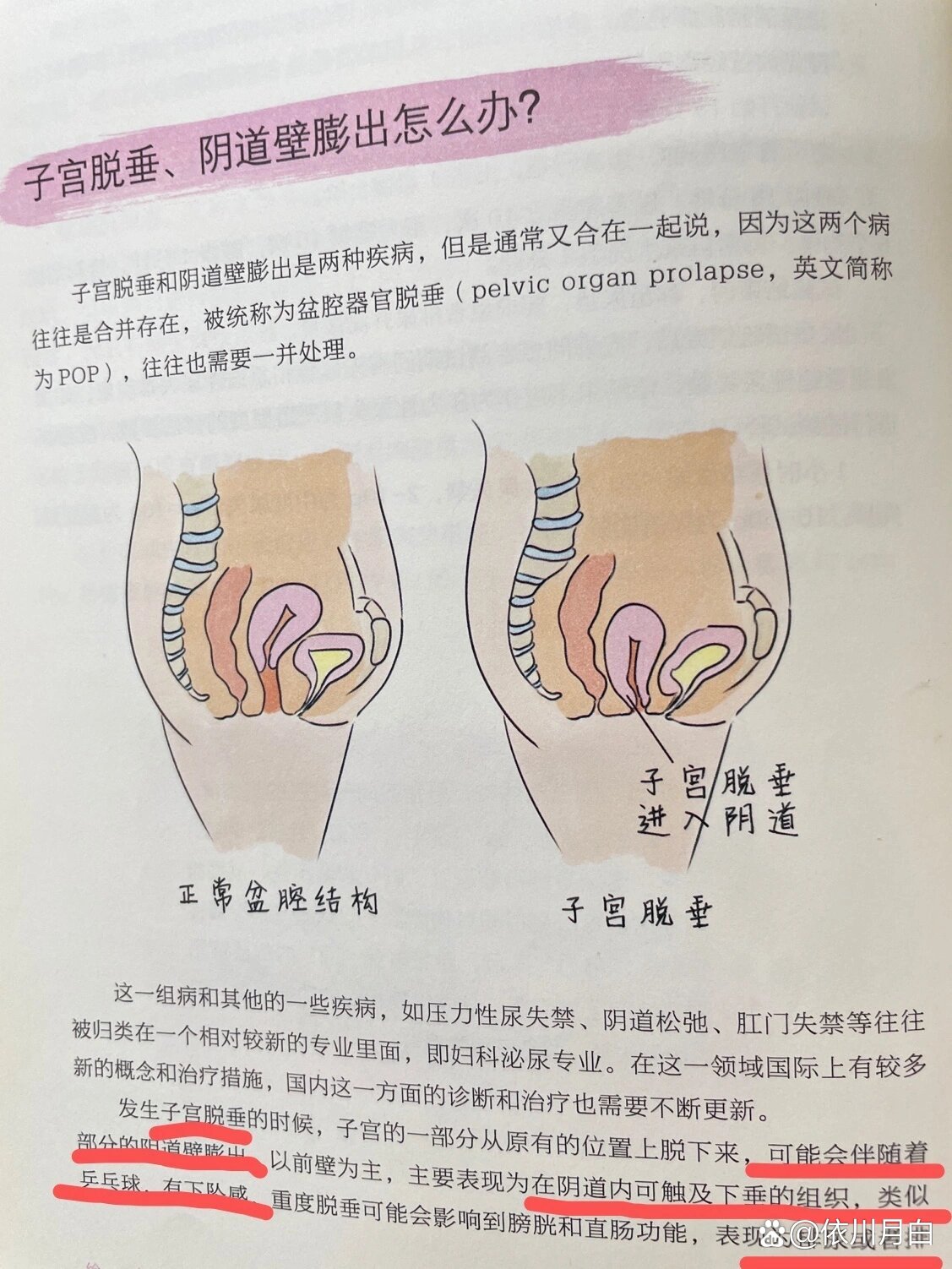 子宫下垂有什么症状_(子宫下垂有什么办法恢复正常)
