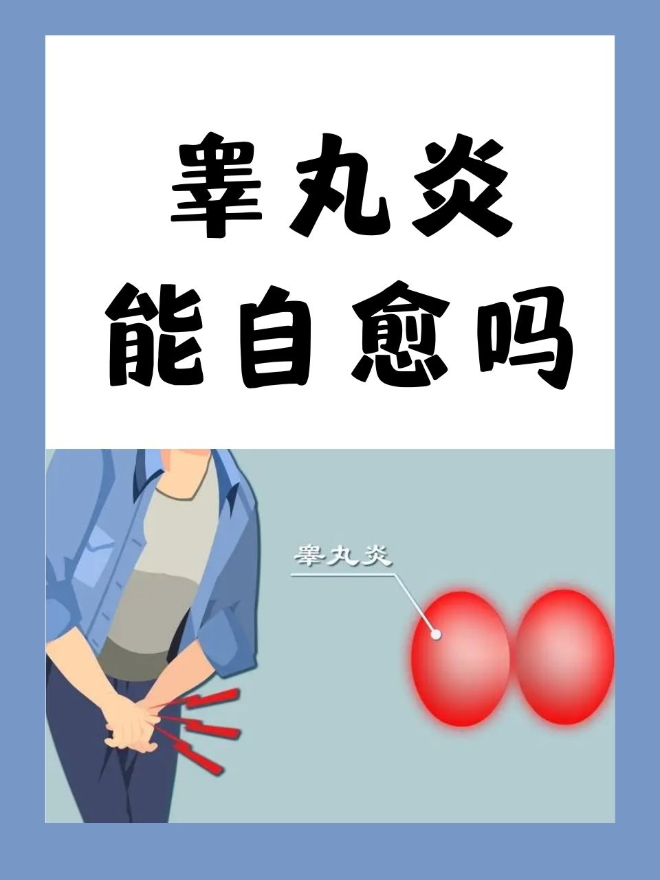 精囊炎(精囊炎症状表现有哪些)