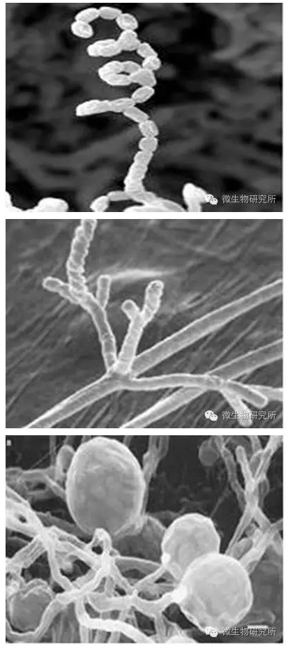 放线菌是细菌还是真菌_(放线菌是细菌还是真菌题库)
