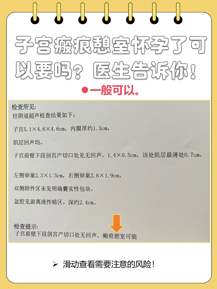 子宫憩室_(子宫憩室一般三处疼)