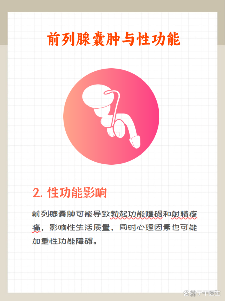 前列腺囊肿-(前列腺囊肿是怎么回事严重不严重)