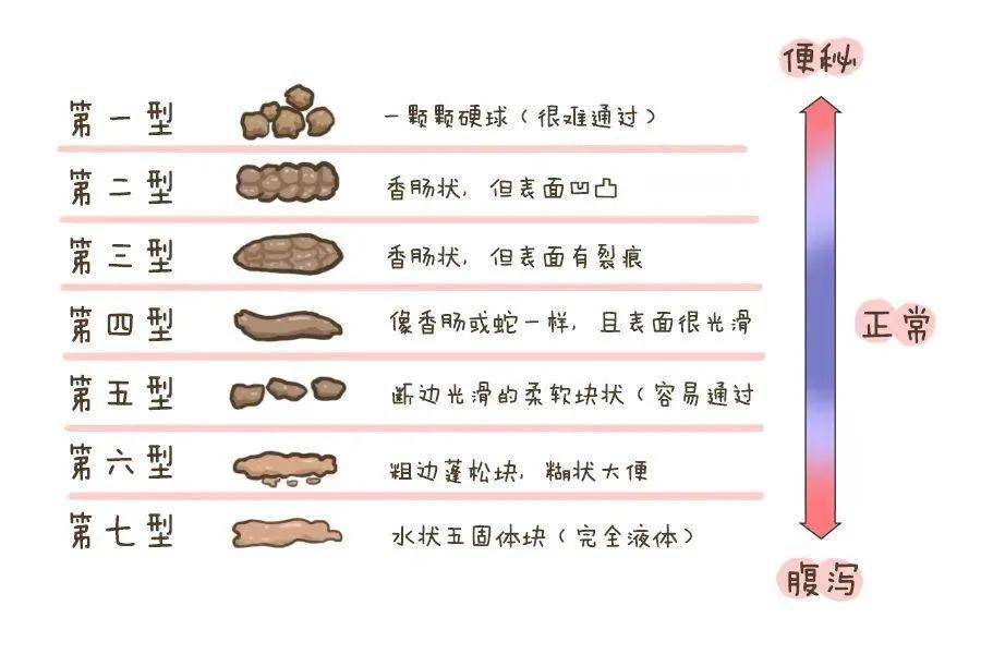 细菌性痢疾的粪便特点-(细菌性痢疾的粪便特点血中带脓)