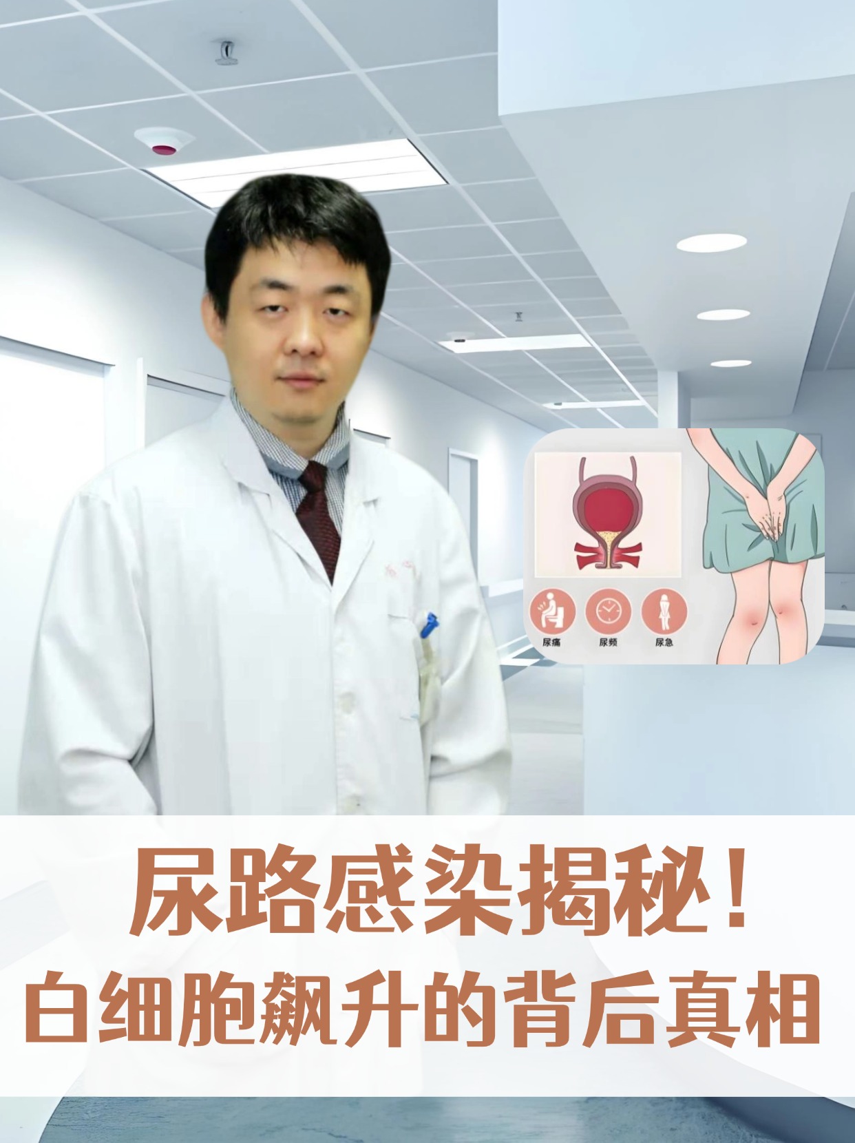 尿常规细菌高怎么回事-(尿常规细菌高怎么回事女性)