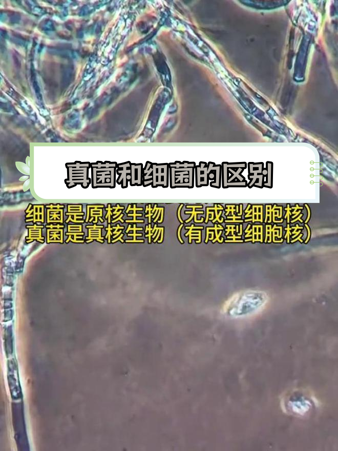 细菌与真菌的区别(毛囊炎细菌和真菌的区别)