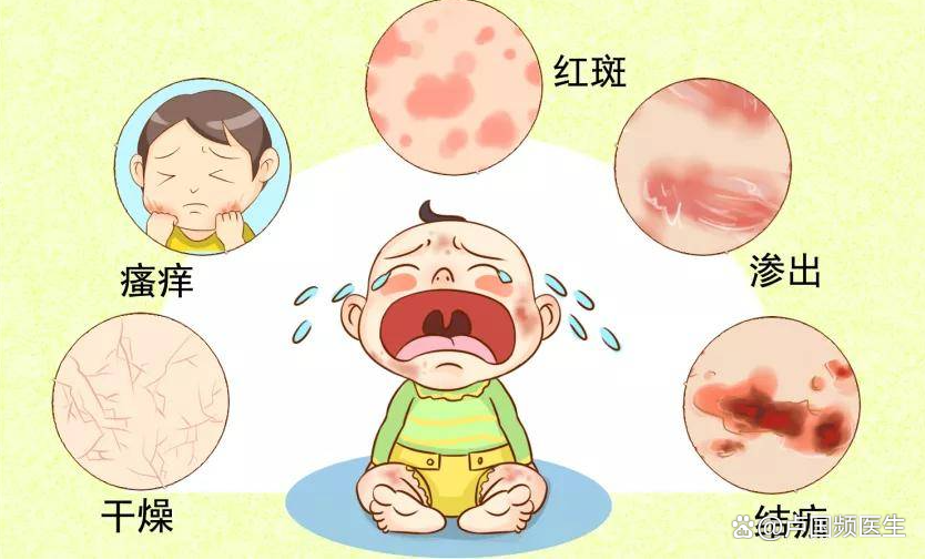 皮肤瘙痒_(皮肤瘙痒警惕9种疾病)
