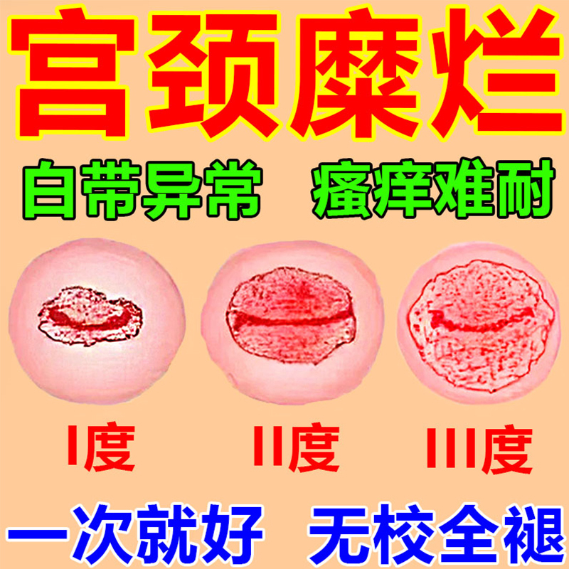 康妇炎胶囊-(康妇炎胶囊经期能吃吗)