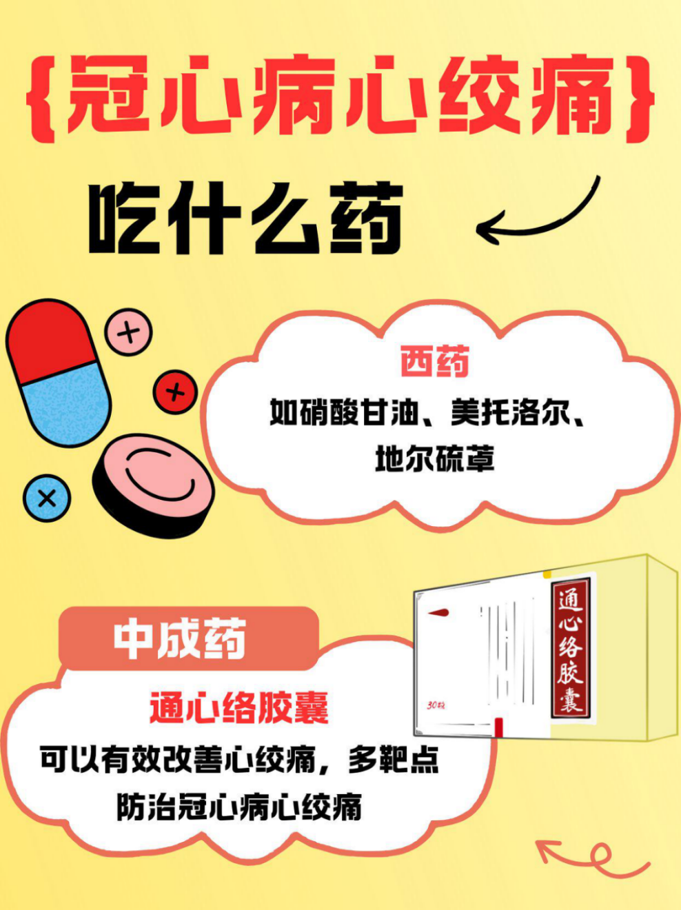 心绞痛常备用药_(心绞痛常备用药速效救心吃几粒丸一次)