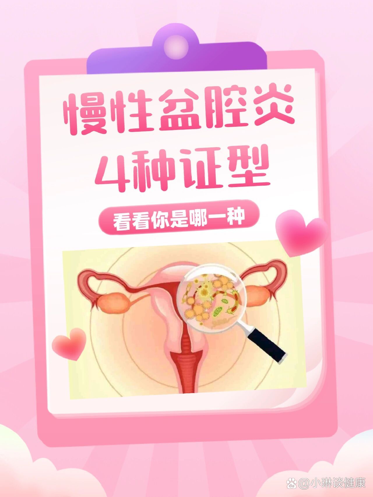 慢性盆腔炎_(盆腔炎是怎么引起的)