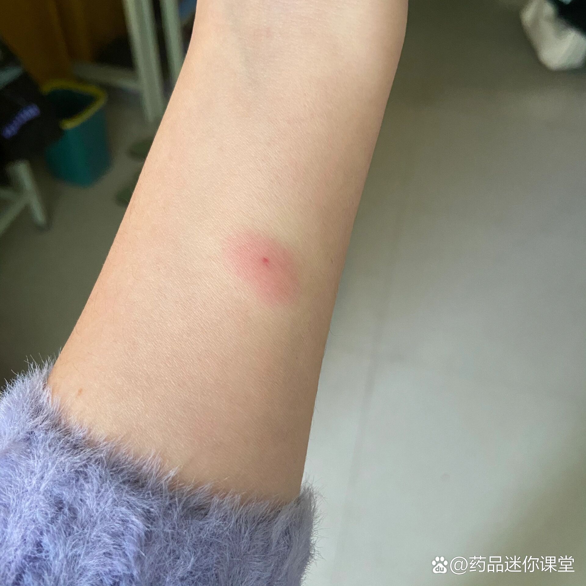 结核菌培养(结核菌培养手工法多长时间出结果)