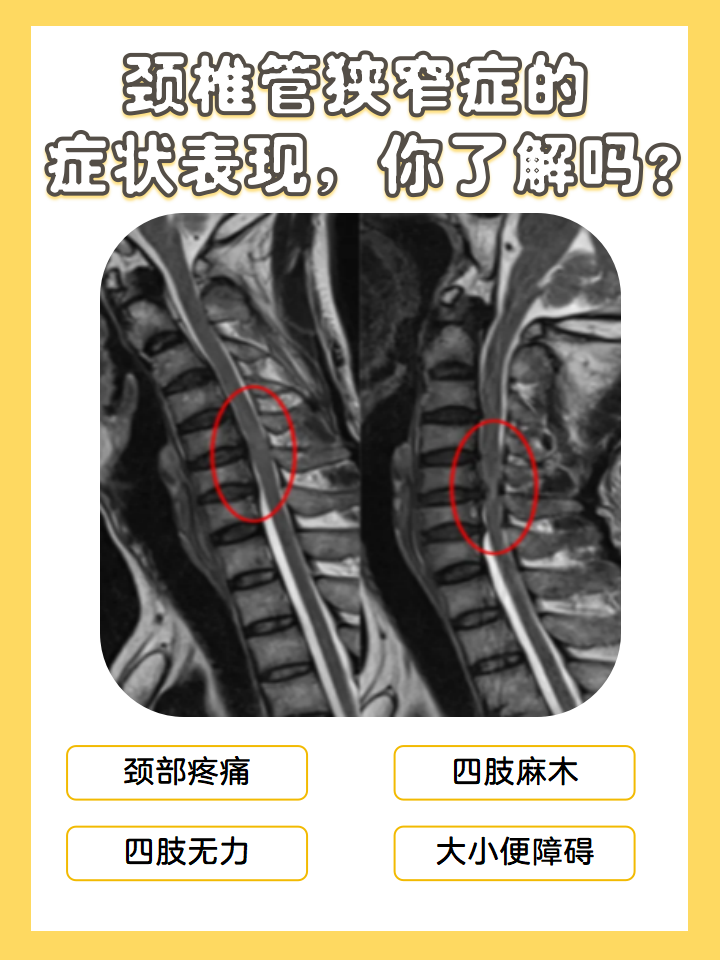 颈椎几节-(右手食指对应颈椎几节)