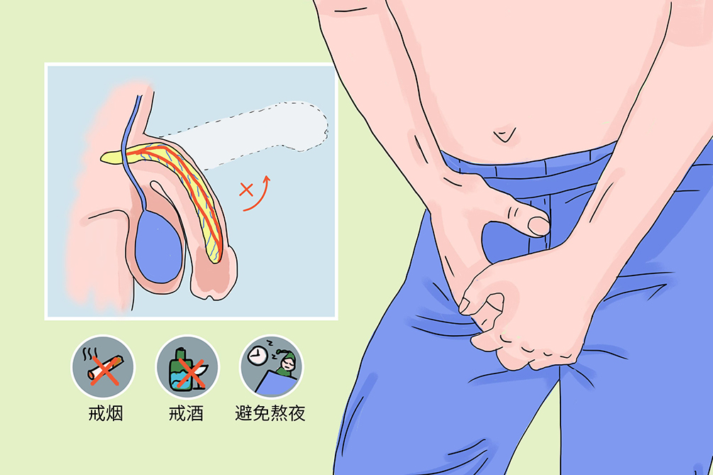 男生插尿管(男生插尿管如何减轻疼痛)