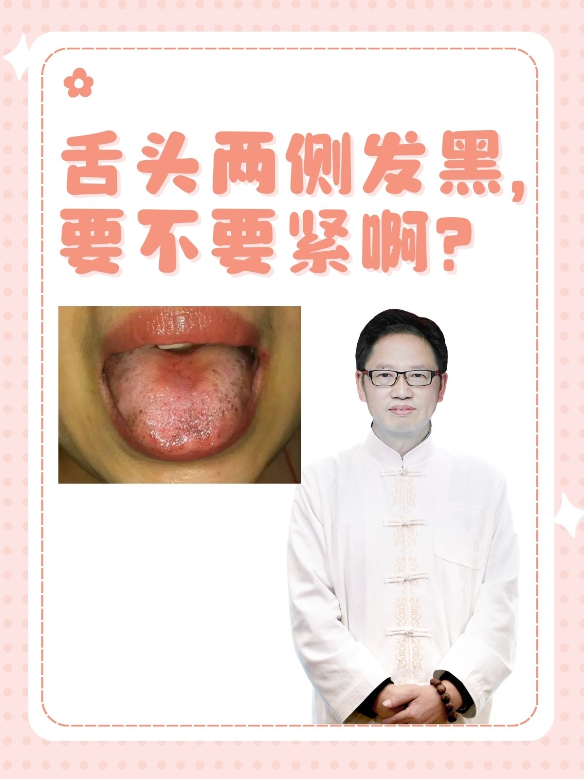 舌头发黑是什么病_(口干舌头发黑是什么病)