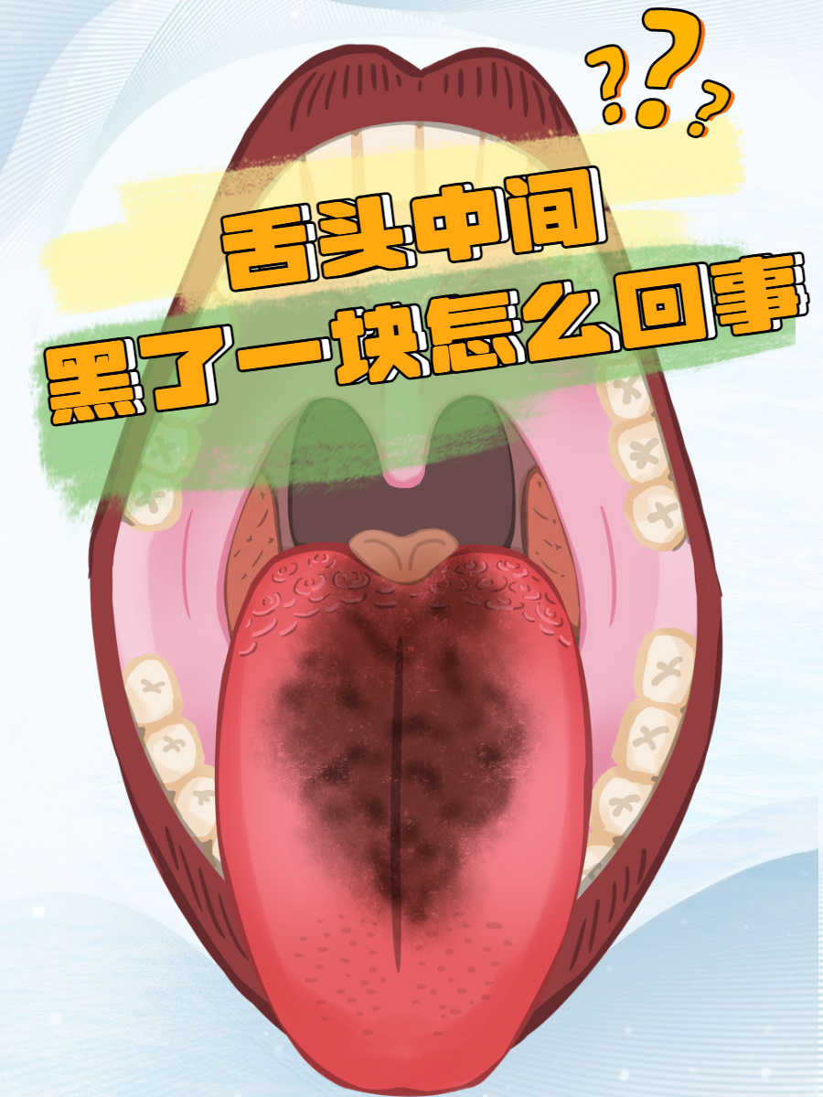 舌头发黑是什么病_(口干舌头发黑是什么病)