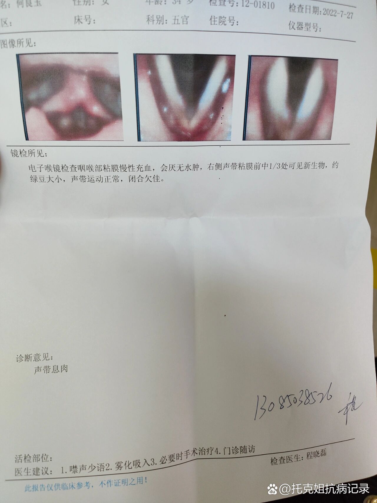 声带充血_(声带充血肿胀声音嘶哑怎么治疗)