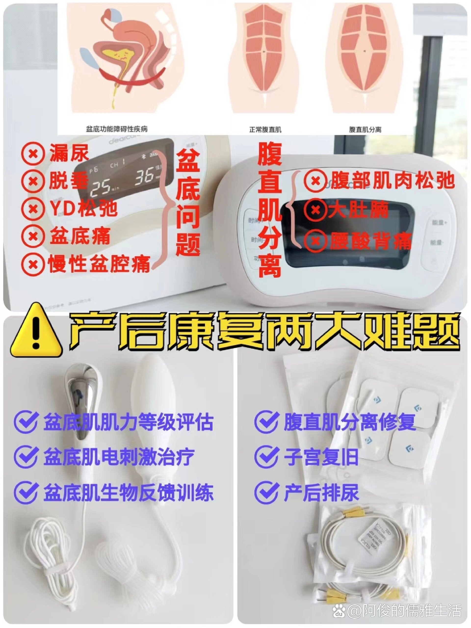 盆底肌康复怎么做(盆底肌康复做一次要多长时间)