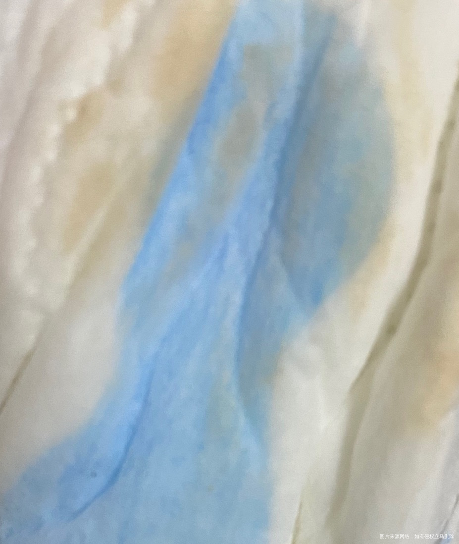 下体流黄色液体-(下体流黄色液体有异味怎么办)