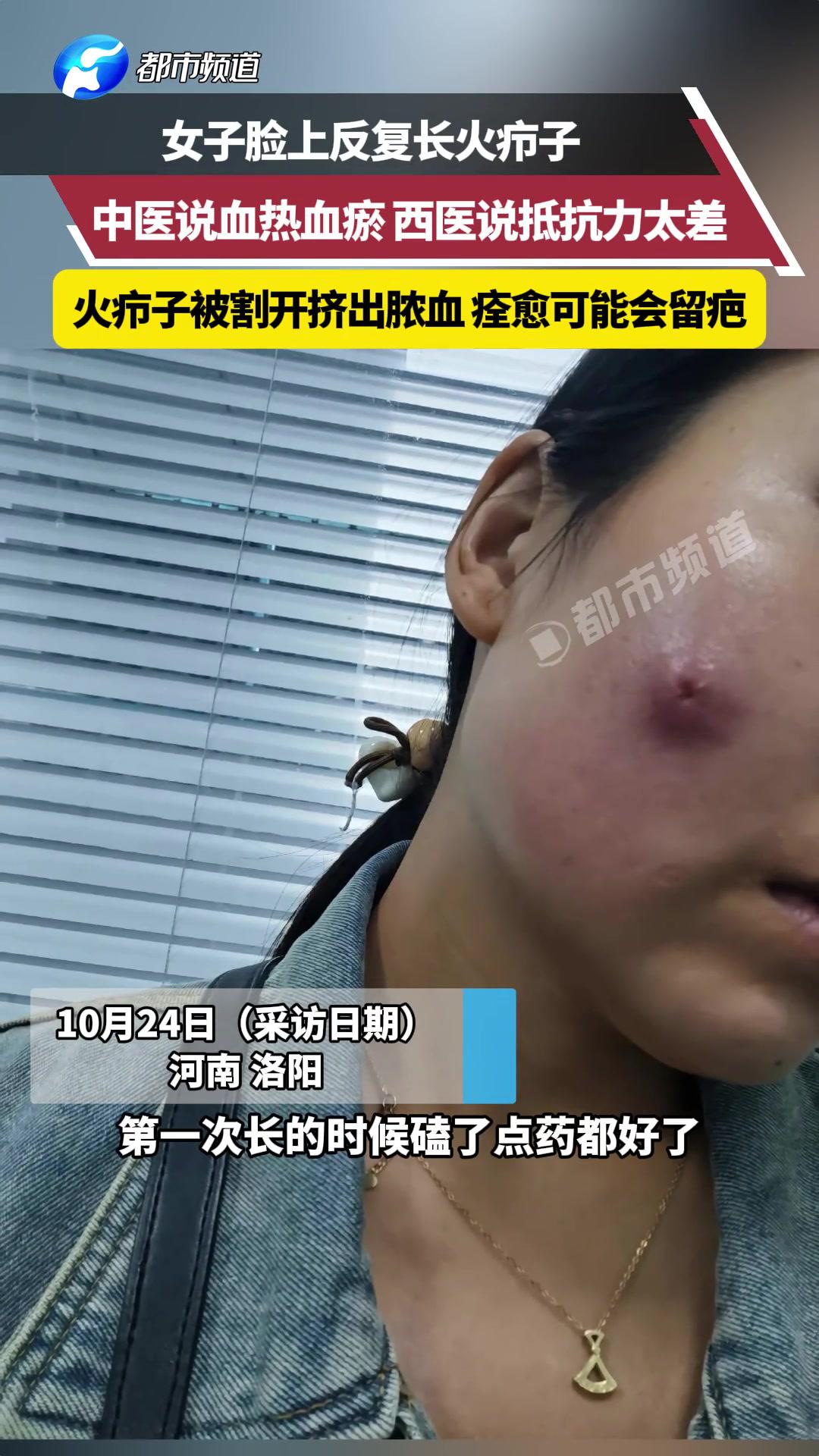 会阴长疖子(妇科疖肿的症状图片)