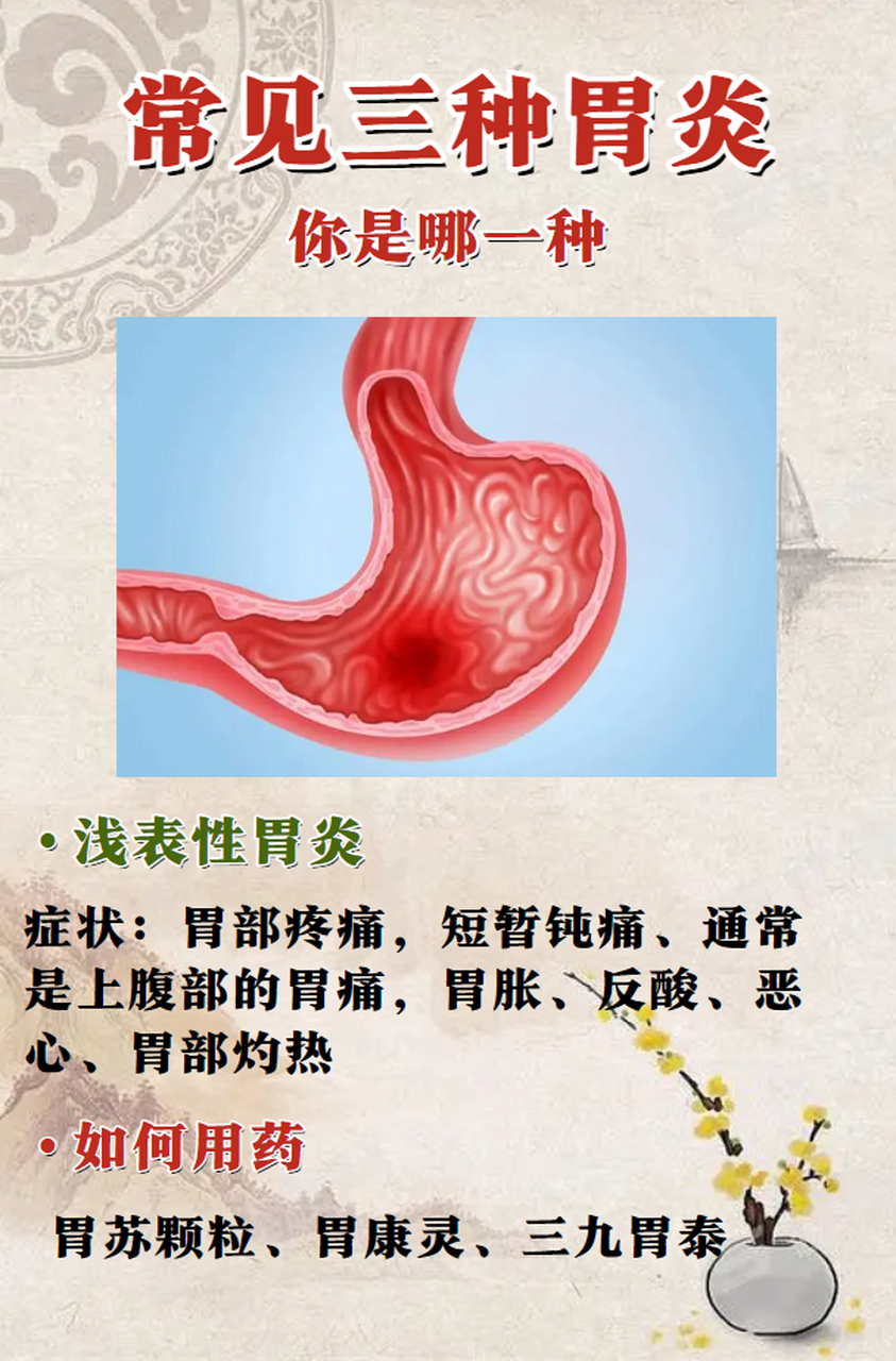得胃病有哪些症状(三个症状说明已有胃癌了)