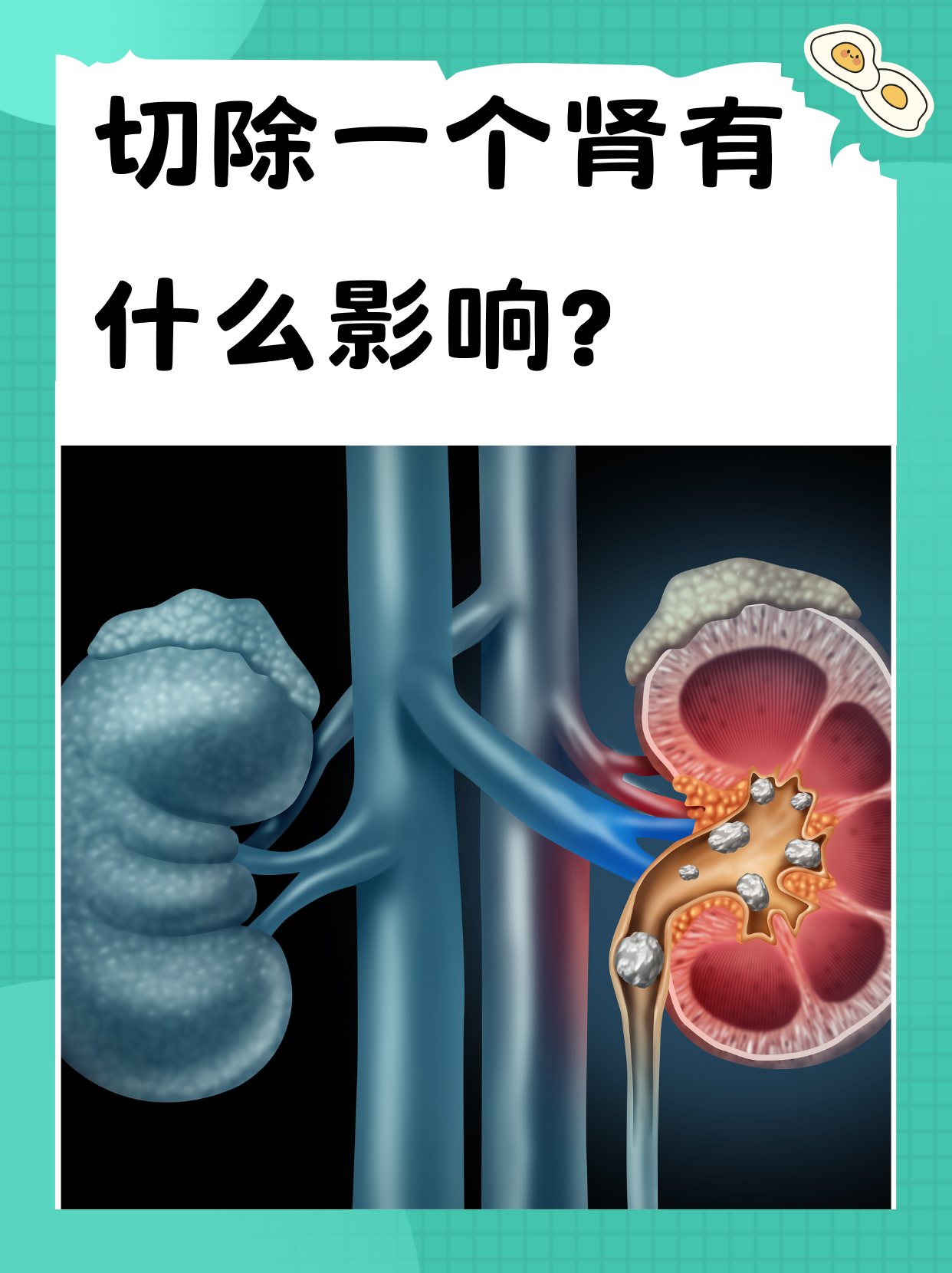 人有几个肾-(人有几个肾小球)