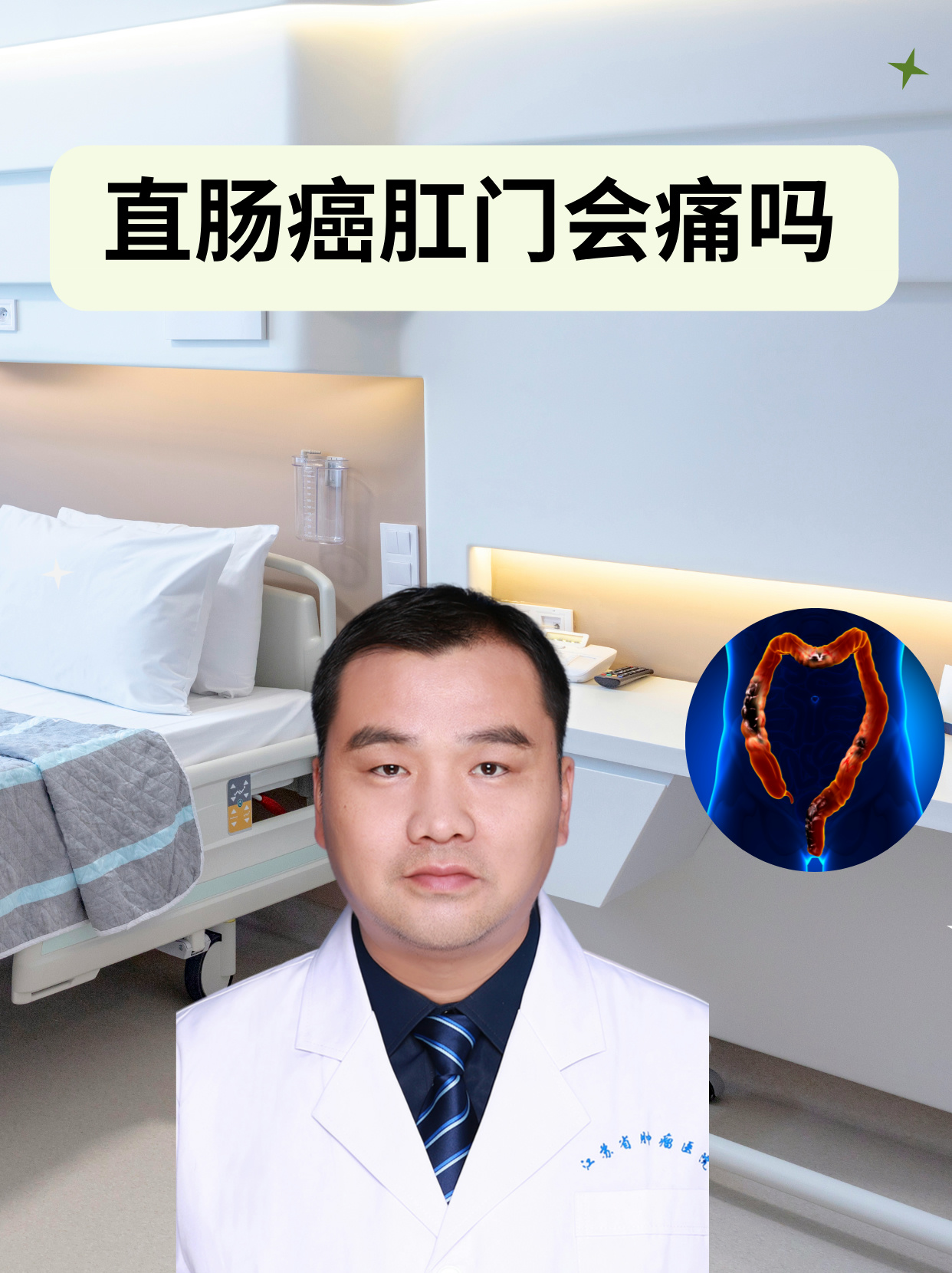 肛门痛挂什么科(肛门痛挂什么科女性)