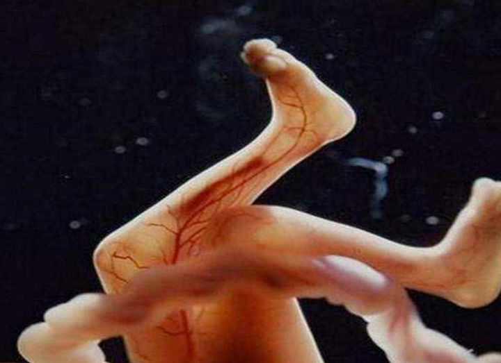 打掉-(怀孕最晚多久可以打掉)