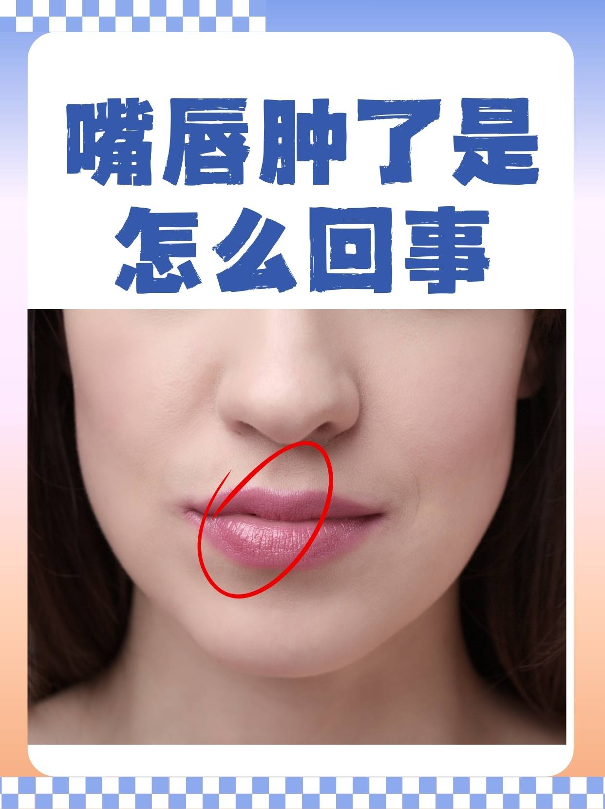 嘴唇红是什么原因_(嘴唇红是什么原因引起的怎么治疗)