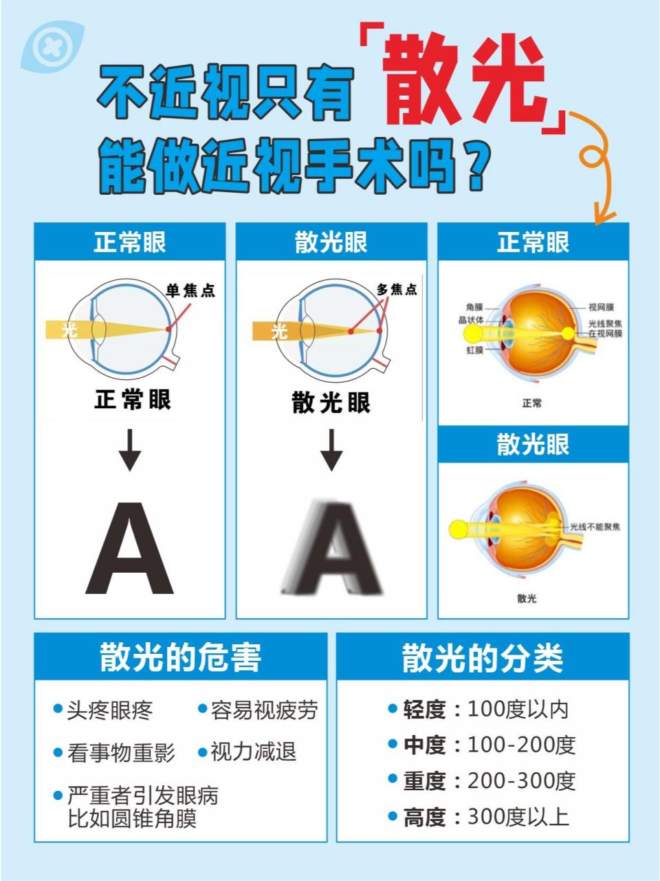75度散光严重吗(近视75度散光50度可以戴125度的眼镜吗)
