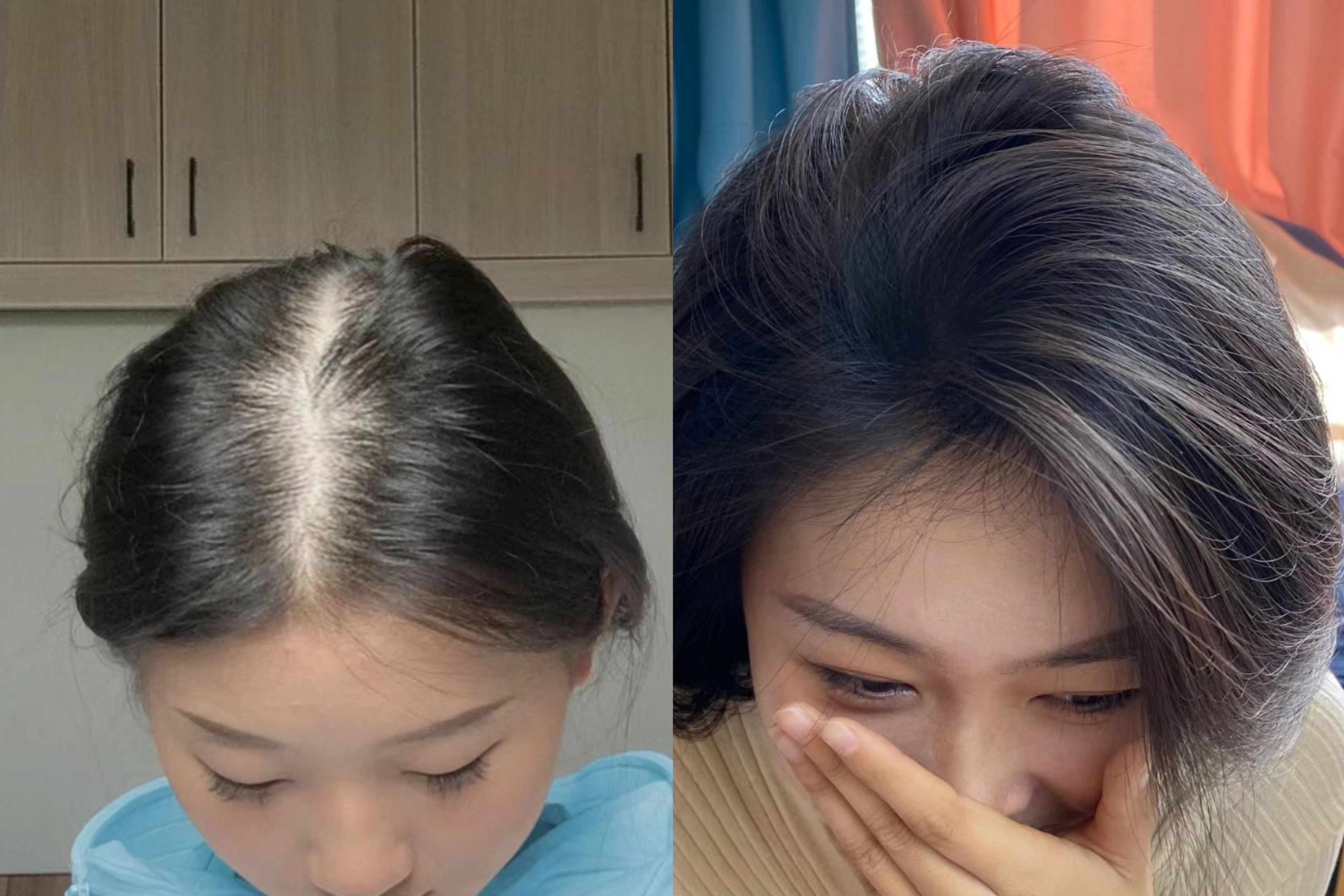 减肥掉头发怎么办-(减肥掉头发怎么办女性)