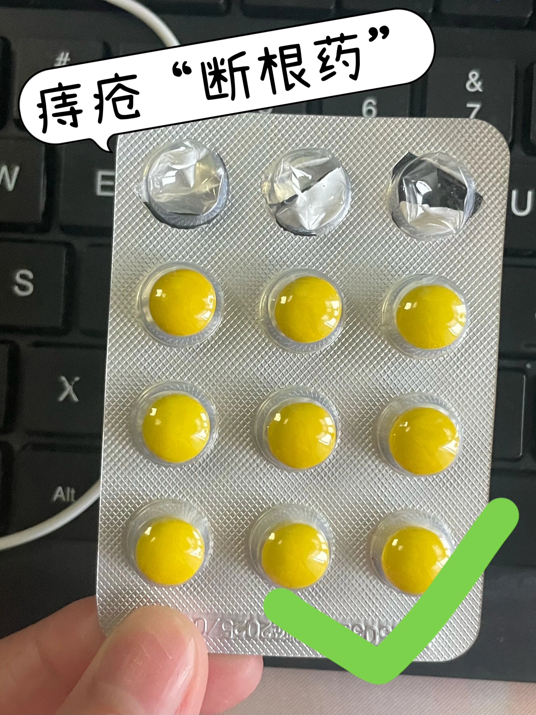 土方治痔疮(土方治痔疮涂上药后脱出枯萎了)