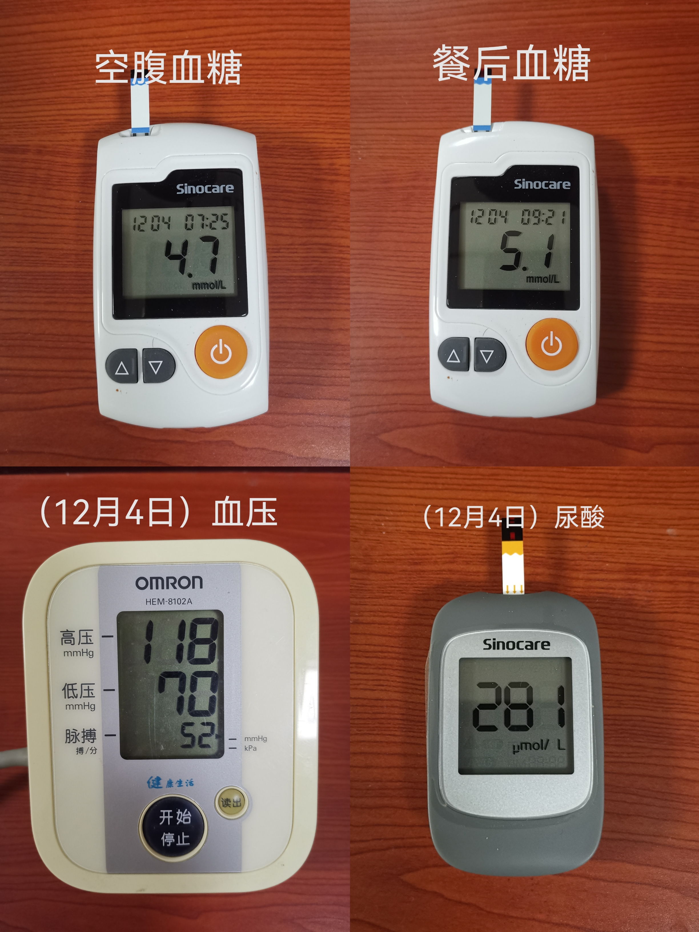 血糖是什么意思-(血糖高是什么意思)