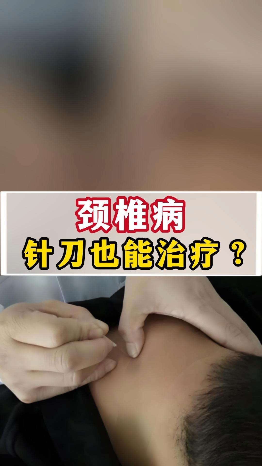 颈椎病能治疗好吗-(颈椎病能治疗好吗?方法很重要)
