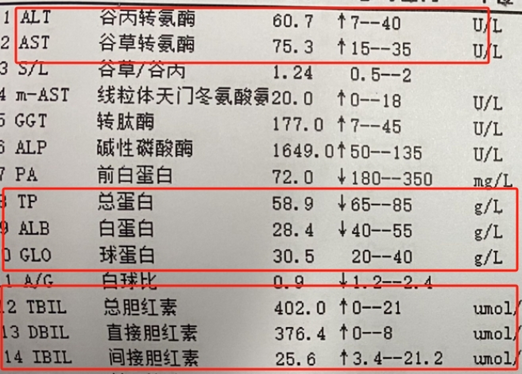 肝功能检查-(肝功能检查需要空腹吗)